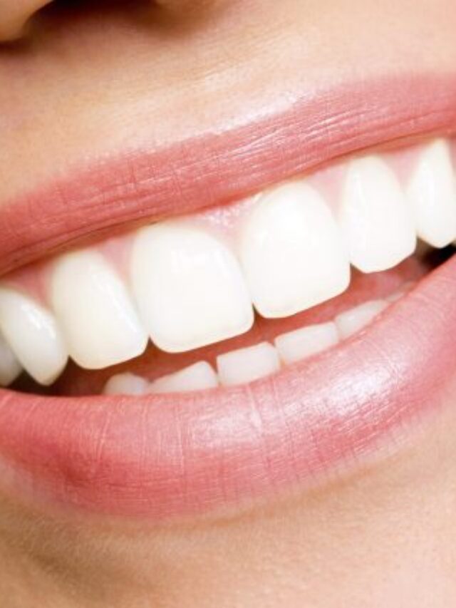 white-teeth-925x425